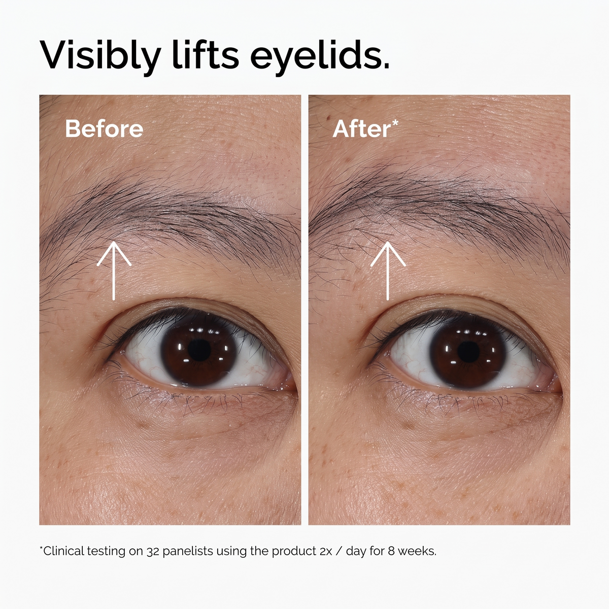 Lacto-PDRN* 4% + B9 Eye Cream