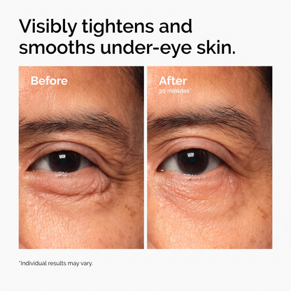 Lacto-PDRN* 4% + B9 Eye Cream